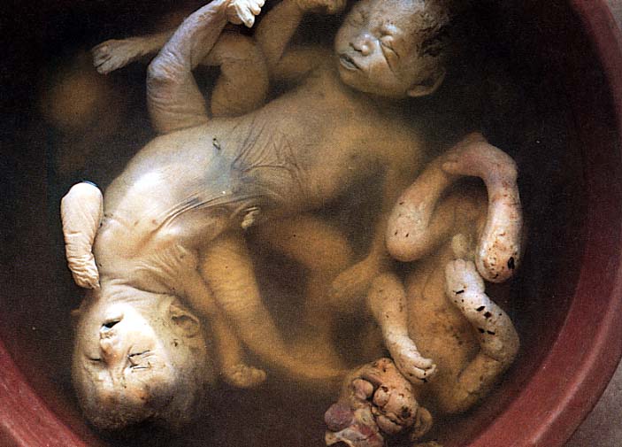Mismaakte baby's door radioactief afval van oorlogsvoering
